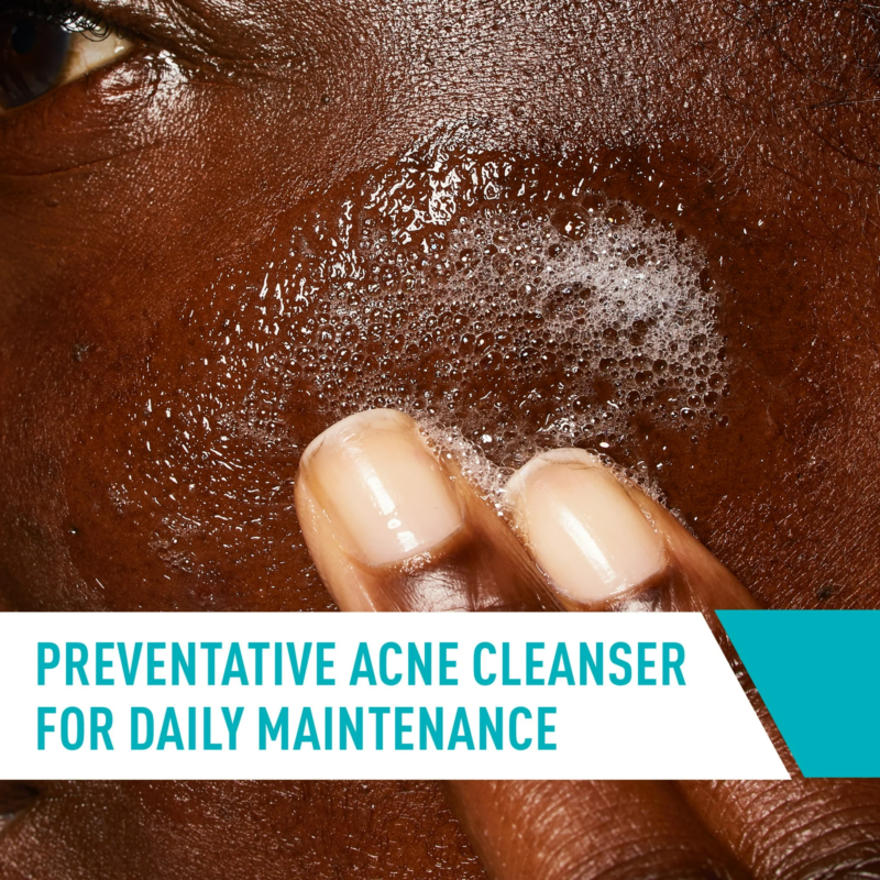 CeraVe Acne Face Wash, Acne Cleanser with Salicylic Acid and Purifying Clay for Oily Skin, 16 fl oz - Image 4